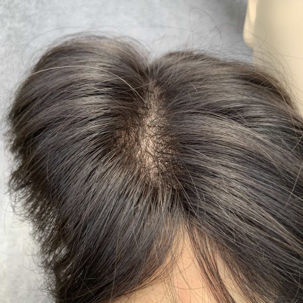 Tóc đẹp che hói đỉnh đầu nam - mẫu TD14 - Ảnh 8