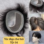 Tóc đẹp che hói đỉnh đầu nam - mẫu TD14